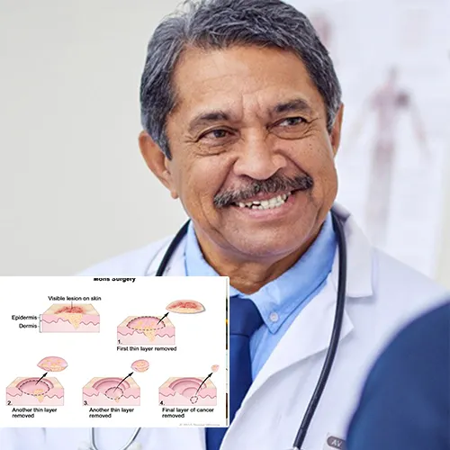Understanding the Impact of Penile Implant Surgery